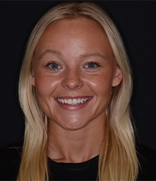 Pinnacle Peak Family Dentistry dental assistance, Cassie Harten.
